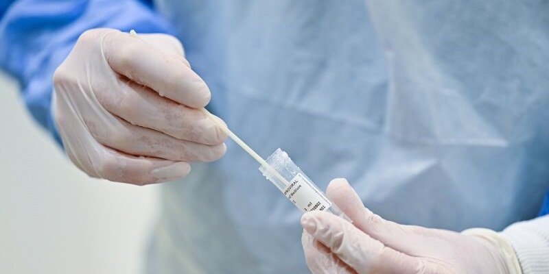 Acre registra mais de 60 novos casos por covid-19 nesta segunda-feira