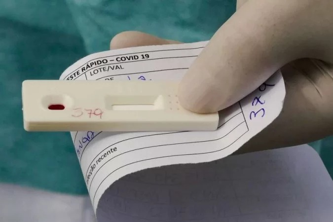 Covid-19: Acre registra 1.028 casos nesta sexta-feira