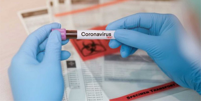 Acre registra mais de 400 casos por covid-19 nesta quarta-feira