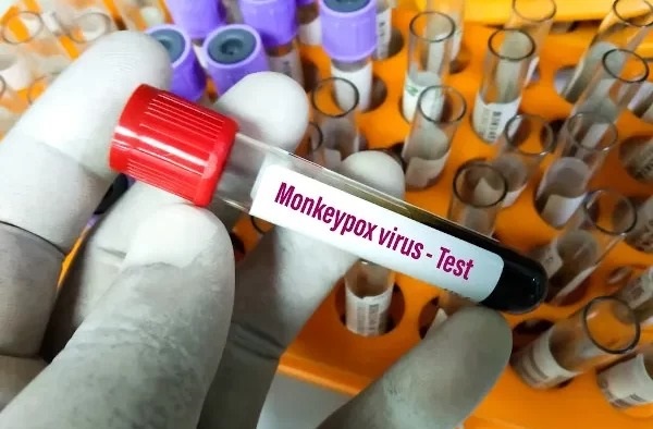 Sesacre já descartou 15 casos suspeitos de varíola dos macacos em todo o Estado