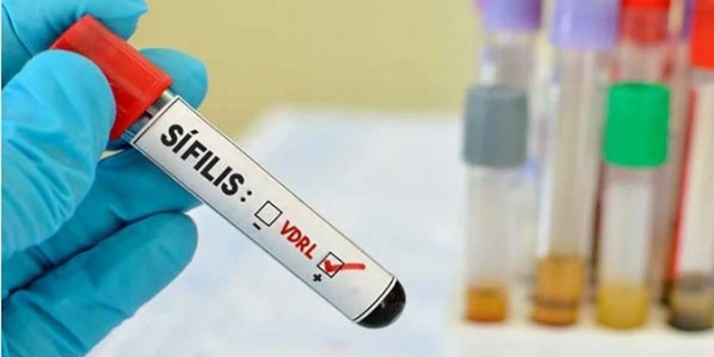 Casos de Sífilis aumentam em Rio Branco e preocupa autoridades em saúde