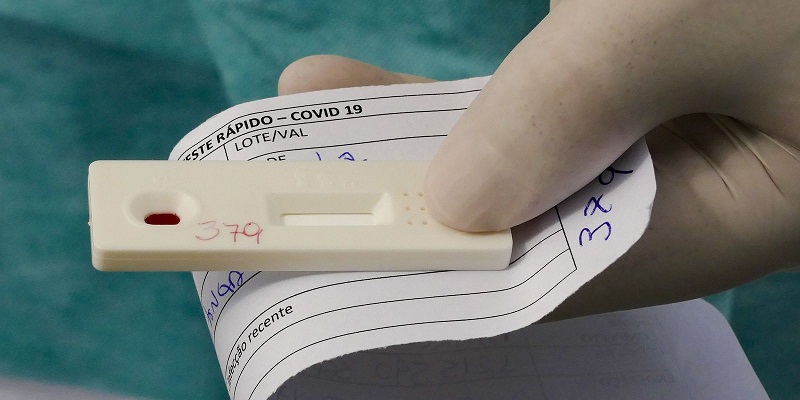 Acre registra 153 novos casos de coronavírus nesta quinta-feira