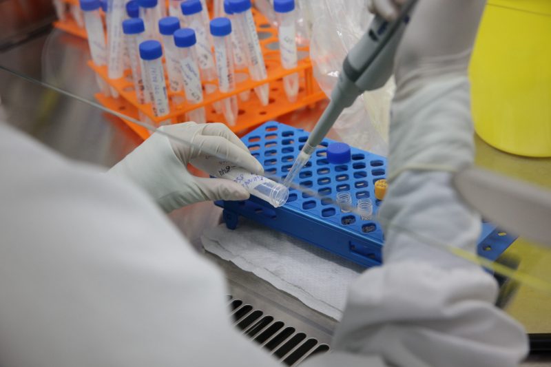 Saúde notifica caso suspeito de monkeypox no Acre