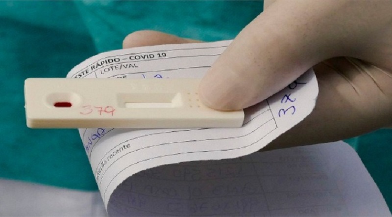 Acre registra 119 casos de coronavírus e um óbito pela doença nesta segunda-feira