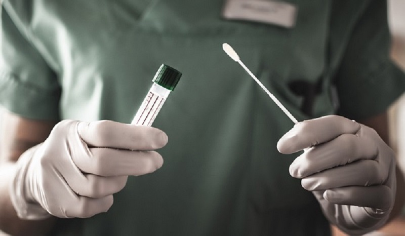 Acre registra 317 novos casos de coronavírus nesta sexta-feira