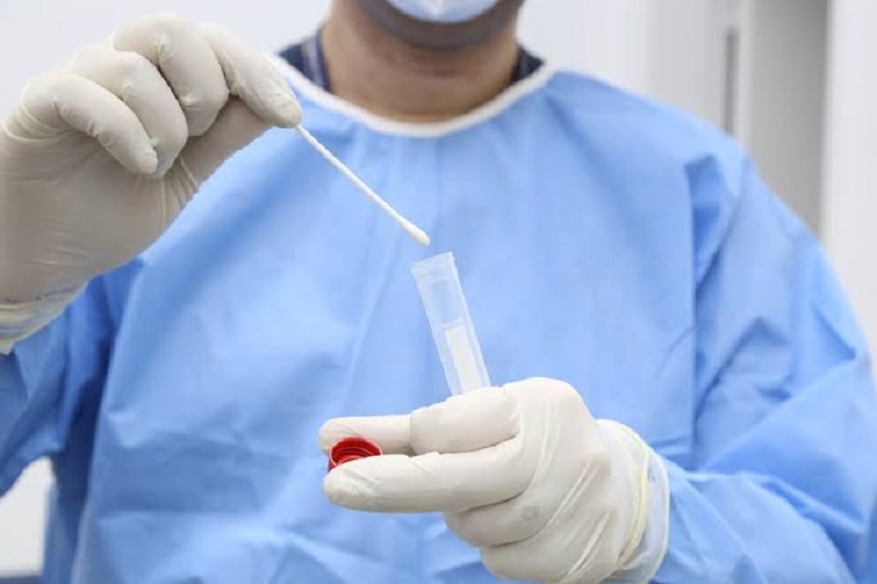 Saúde descarta último caso suspeito de monkeypox no Acre