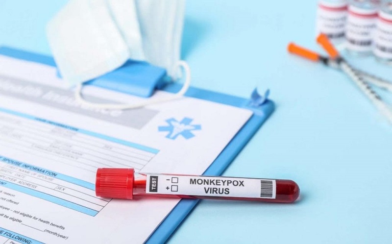 Saúde do Acre descarta último caso suspeito de monkeypox no estado