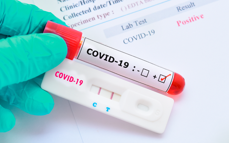 Acre registra 20 novos casos de coronavírus de 11 a 17 de fevereiro