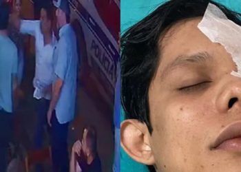 Justiça nega pedido de prisão contra empresário acusado de agredir jovem com copo de vidro em Brasiléia