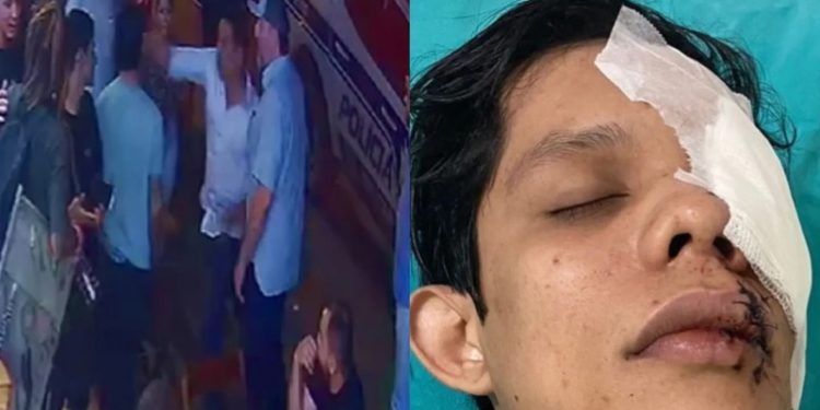 Justiça nega pedido de prisão contra empresário acusado de agredir jovem com copo de vidro em Brasiléia