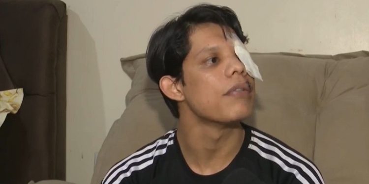 Jovem que perdeu olho após ser agredido com copo de vidro dá primeira entrevista e conta detalhes; confira