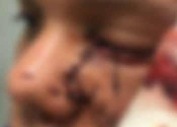 MPAC pede prisão preventiva de empresário que agrediu jovem em Brasileia