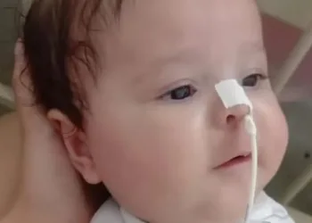 Sesacre se pronuncia sobre morte de bebê que precisava do remédio mais caro do mundo