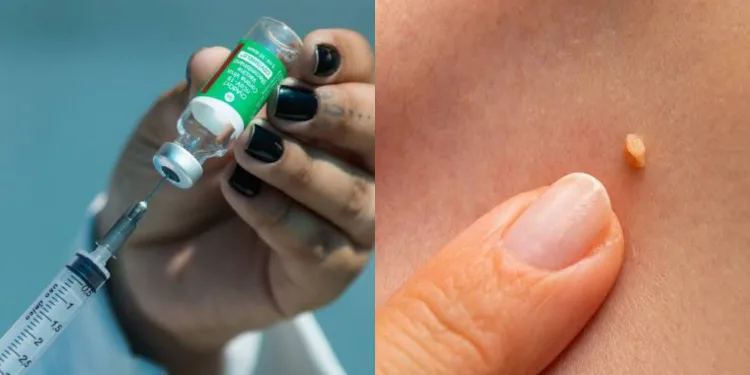 Brasil passa a adotar esquema de dose única contra o HPV