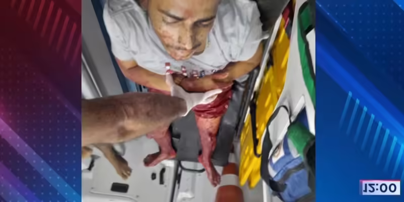 Em Brasiléia, dois homens ficaram em estado grave após serem baleados neste final de semana