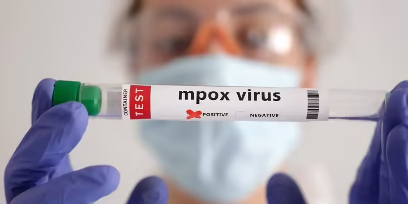 Brasil supera marca de mil casos de mpox em 2024