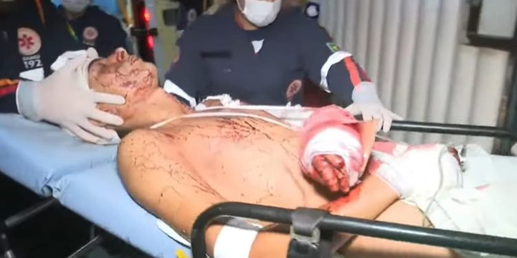 Jovem de 20 anos sofre tentativa de homicídio a golpes de terçado em Senador Guiomard