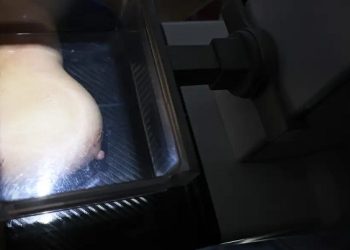 Mulheres de baixa renda terão exames gratuitos de câncer de mama