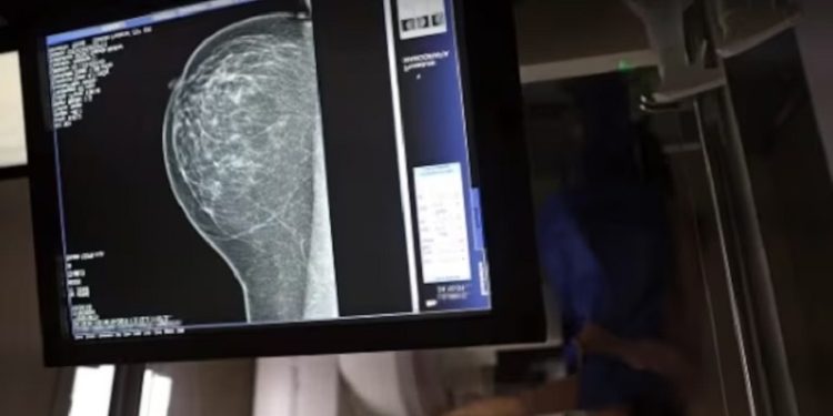 Decreto permite afastamento de servidores e terceirizados para exame preventivo de câncer