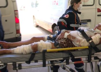 Casal é atacado por cães Rottweiler e mulher fica gravemente ferida no bairro Alto Alegre