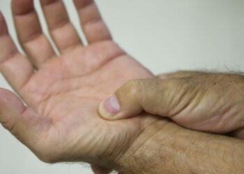 Lei define fibromialgia como deficiência em todo país a partir de 2026