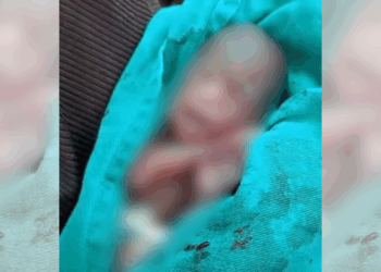 Bebê declarado morto acorda durante o próprio velório após 13 horas dentro de um saco em Rio Branco