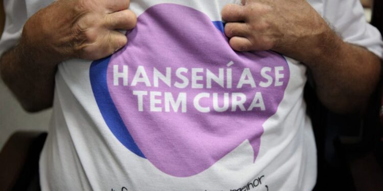 Rio Branco cria Política Municipal de Educação Preventiva e de Combate ao Preconceito contra a Hanseníase