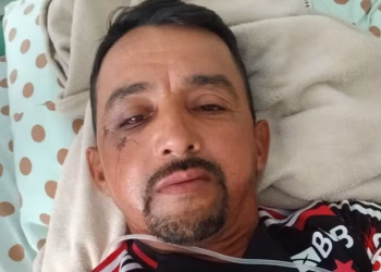 Gari ferido por tijolada no rosto tem cirurgia marcada para quarta-feira