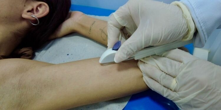 Rio Branco realiza ação de saúde e insere mais de 30 implantes contraceptivos em mulheres em situação de rua